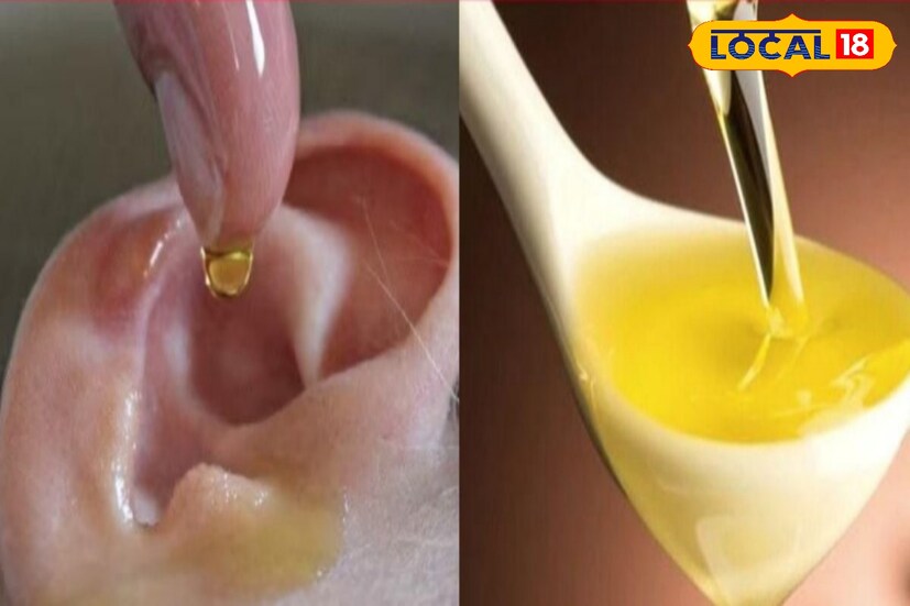 কানের মোম নরম করতে সপ্তাহে অন্তত একবার প্রতিটি কানে এক ফোঁটা অলিভ অয়েল দিয়ে রেখে দিতে হবে। কিছুক্ষন বাদে দেখা যাবে ময়লা খুব সহজেই কানের বাইরে বেরিয়ে যাচ্ছে।