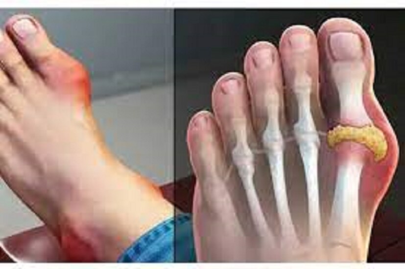 তাই দিনের শুরুতেই জোয়ার তারপরে বাজরা খেলে শরীর সুস্থ থাকে, তাই অল্প পরিমাণে শীতের দিনে শরীর গরম গরম রাখে বাজরা ৷ প্রতীকী ছবি ৷