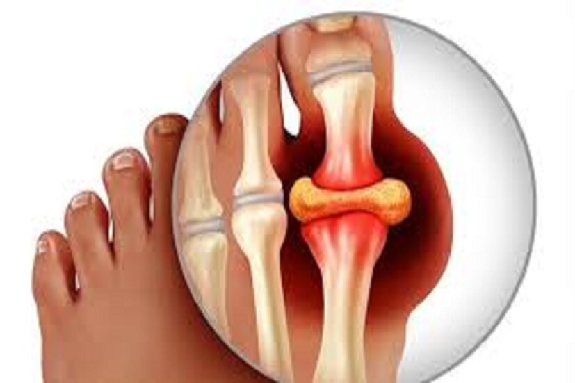 জোয়ার প্রাকৃতিক শস্য যাতে প্রচুর পরিমাণে ইউরিক অ্যাসিড থাকে ৷ বাজরা এমনিতেই গরম, তাই অল্প পরিমাণে জোয়ারের সঙ্গে মিশিয়ে নিয়ে খেলে ভাল ফল পাওয়া সম্ভব ৷ প্রতীকী ছবি ৷