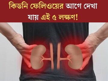 অবহেলা নয়, কিডনি ফেলিওয়ের আগে শরীরে দেখা যায় এই ৫ লক্ষণ! দেখলেই সতর্ক হন