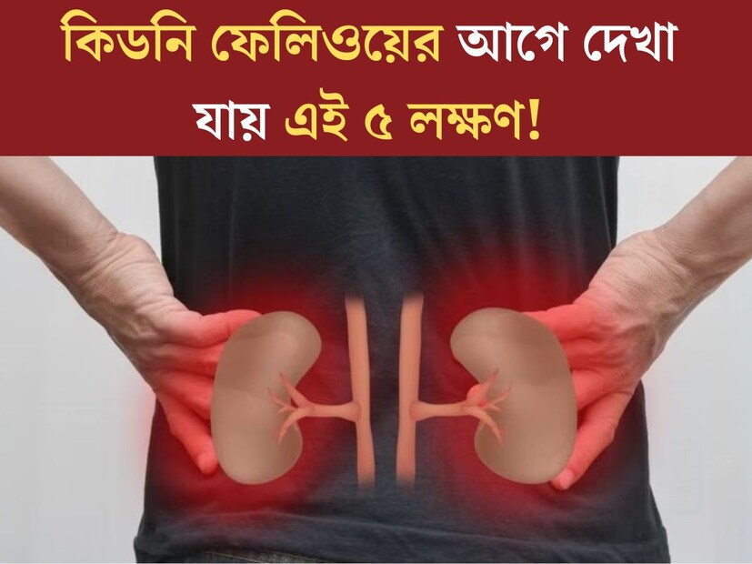 শরীর থেকে সমস্ত ক্ষতিকারক দ্রব‍্য, ময়লা ছেঁকে বের করা। কিন্তু ভুলভাল জীবনযাত্রা, খারাপ খাদ‍্যাভ‍্যাস-সহ একাধিক কারণে বর্তমানে প্রচুর মানুষই কিডনির সমস‍্যায় ভুগছেন। 