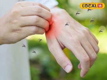 মশা হোক বা পোকামাকড়! ২ মিনিটে কমে যাবে জ্বালা, চুলকুনি! ঘরেই রয়েছে ৫ অস্ত্র