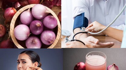 পেঁয়াজে সালফারের উপস্থিতির কারণে এটি কোলাজেন উৎপাদনকে ত্বরান্বিত করে পেঁয়াজে সালফারের উপস্থিতির কারণে এটি কোলাজেন উৎপাদনকে ত্বরান্বিত করে