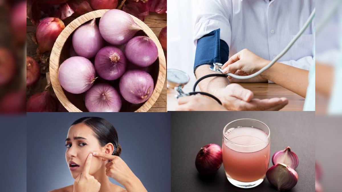 Onion in High Blood Pressure and Pimples: নিংড়ে বার করবে পুরনো কফ থেকে হাই ব্লাড প্রেশার! ব্রণ সারিয়ে গজাবে নতুন চুল! শুধু পেঁয়াজের রস খান এবং মাখুন এভাবে