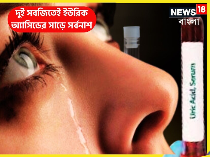 ইউরিক অ্যাসিডের পরিমাণ সীমানা ছাড়ালেই বিপদ দেখা দেয় ৷ প্রতিটি মানুষেরই শরীরে ইউরিক অ্যাসিড নির্দিষ্ট পরিমাণে থাকে ৷ প্রতীকী ছবি ৷