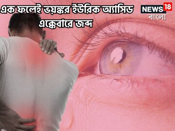 সস্তার ফলে হাড় থেকে ইউরিক অ্যাসিডের ব্যথা-যন্ত্রণা টেনে বের করে চিরতরে!