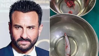 সইফের পিঠে ঢুকেছিল এই ছুরি সইফের পিঠে ঢুকেছিল এই ছুরি