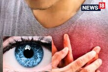 চোখ দিয়েই বোঝা যাবে স্ট্রোকের পূর্বাভাস! নিয়ম মেনে শুধু করতে হবে এই কাজ...
