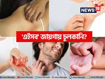 শরীরে 'এইসব' জায়গায় চুলকানি! কীসের লক্ষণ জানেন? সতর্ক হন, নইলে..!