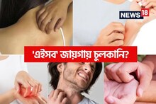 শরীরে 'এইসব' জায়গায় চুলকানি! কীসের লক্ষণ জানেন? সতর্ক হন, নইলে..!