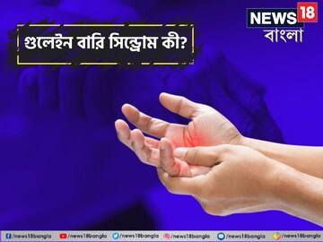 প্রতীকী ছবি৷ 