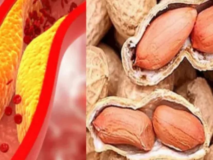 **ফাইবার সমৃদ্ধ খাবার**  আপনার খাদ্যতালিকায় ফাইবার সমৃদ্ধ ফল ও সবজি অবশ্যই অন্তর্ভুক্ত করুন। আপেল, নাশপাতি, রাজমা এবং স্প্রাউটসের মতো জিনিস চেষ্টা করতে পারেন। এগুলোর ফাইবার রক্তে জমে থাকা কোলেস্টেরল দূর করতে সহায়তা করে। এগুলো সঠিক পরিমাণে এবং সঠিক উপায়ে খেলে তাৎক্ষণিক ফলাফল দেখা যাবে।  
