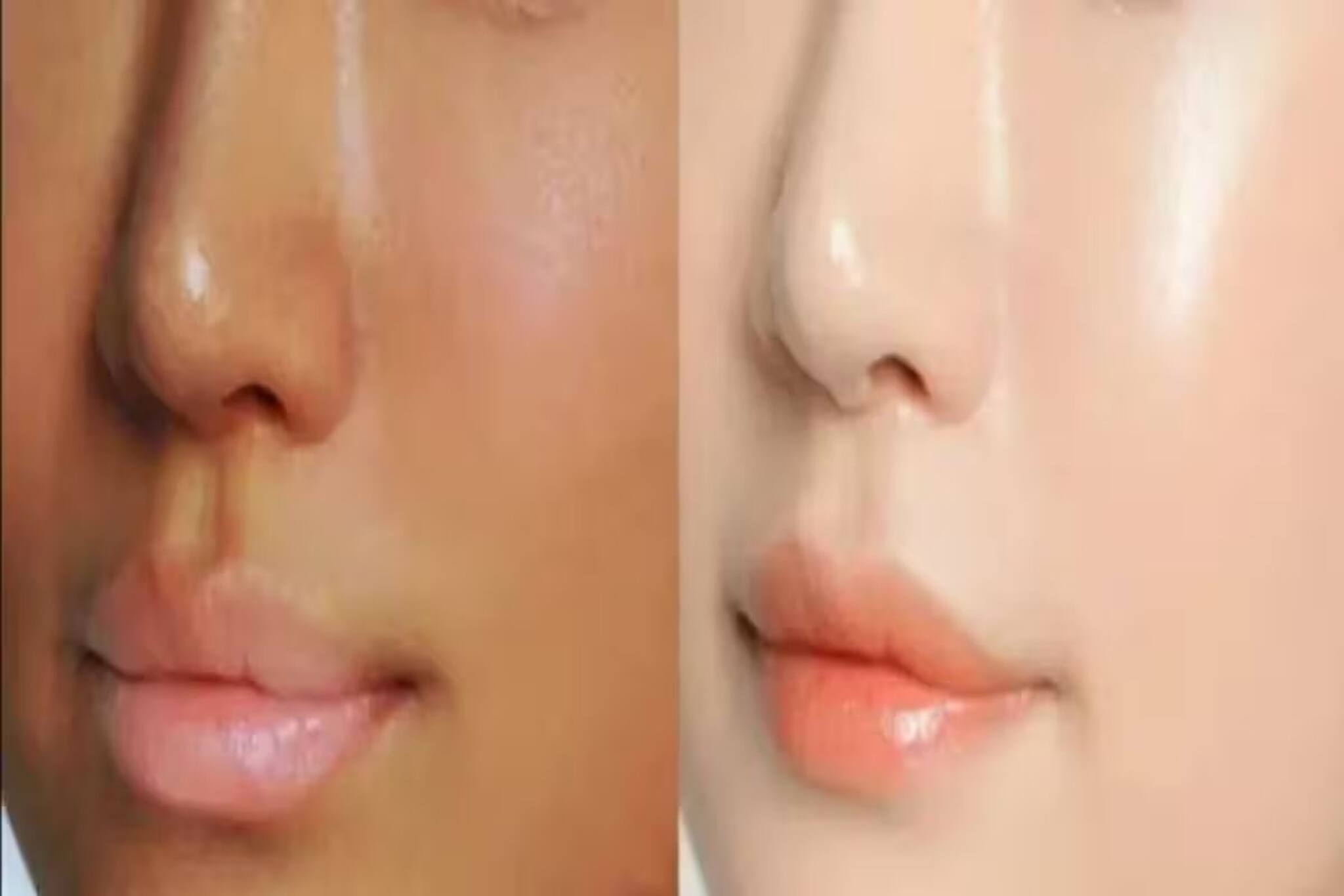 আয়নার মতো ঝকঝক করবে মুখ..! প্রতি রাতে এই 'জিনিস' দিয়ে করুন ফেস ম্যাসাজ! ঠিকরে পড়বে জেল্লা