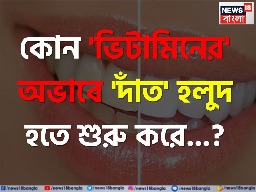 ট্রেন্ডিং কুইজ: মানুষের জ্ঞান বাড়াতে দুর্দান্ত কার্যকরী ভূমিকা নেয় সাধারণ জ্ঞানের চর্চা। আবার একইসঙ্গে সুস্থ জীবন যাপনের জন্যেও প্রয়োজন হয় কিছু স্বাস্থ্য ও জীবনধারা সংক্রান্ত সাধারণ জ্ঞান।