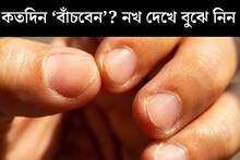 কতদিন ‘বাঁচবেন’ আপনি? নখেই লুকিয়ে বড় ‘ক্লু’! নিজেই দেখে বুঝতে পারবেন কীভাবে? জেনে নিন