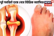 দুই সবজিই কামাল দেখাবে! গাঁট থেকে টেনে বের করবে অসহ্য ব্যথা-যন্ত্রণা ইউরিক অ্যাসিডে