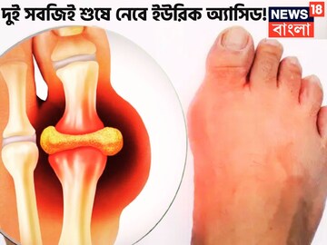 দুই সবজিই কামাল দেখাবে! গাঁট থেকে টেনে বের করবে অসহ্য ব্যথা-যন্ত্রণা ইউরিক অ্যাসিডে দুই সবজিই কামাল দেখাবে! গাঁট থেকে টেনে বের করবে অসহ্য ব্যথা-যন্ত্রণা ইউরিক অ্যাসিডে