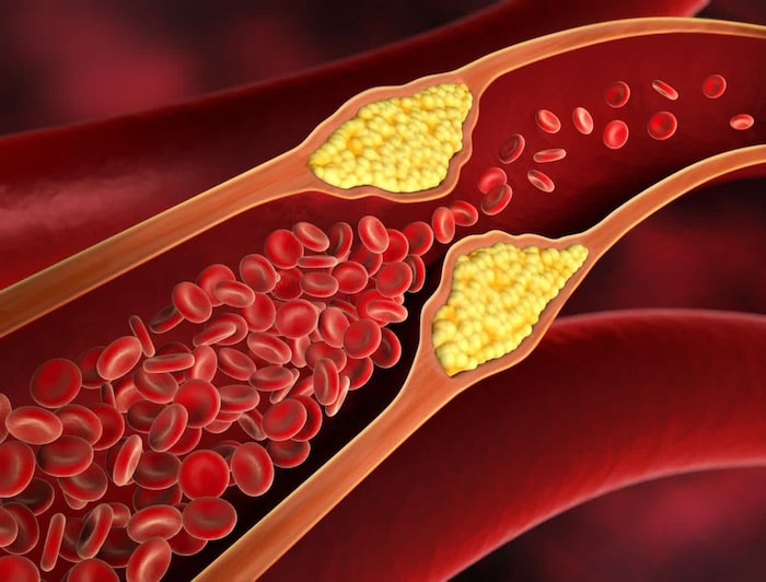 Cholesterol Control Tips: গবগবিয়ে খাওয়াই ডাকে বিপদ! সস্তার এই ৮ টিপস মানলেই কেল্লাফতে, হরহর করে বেড়োবে কোলেস্টেরল