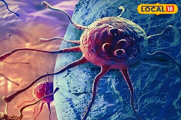 অতিরিক্ত ওজন ক‍্যানসার ডেকে আনতে পারে! এই সহজ নিয়ম মানলে দূরে থাকবে মারণ-রোগ