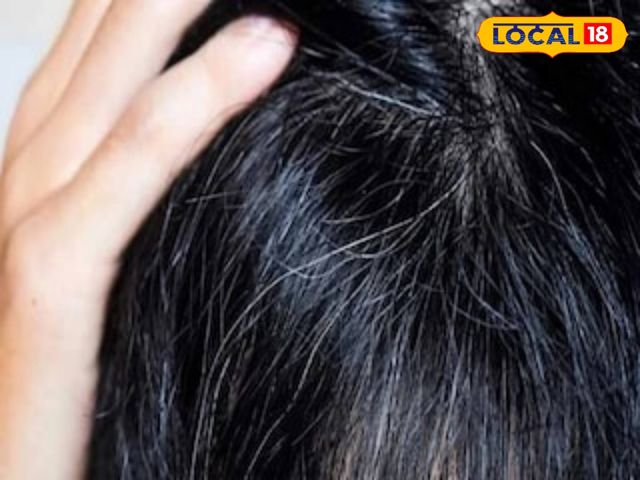 অল্প বয়সে চুল দাড়ি পেকে যাচ্ছে? শরীরে কোন রোগ হয়েছে? ঘরোয়া উপাদানে হবে কাজ