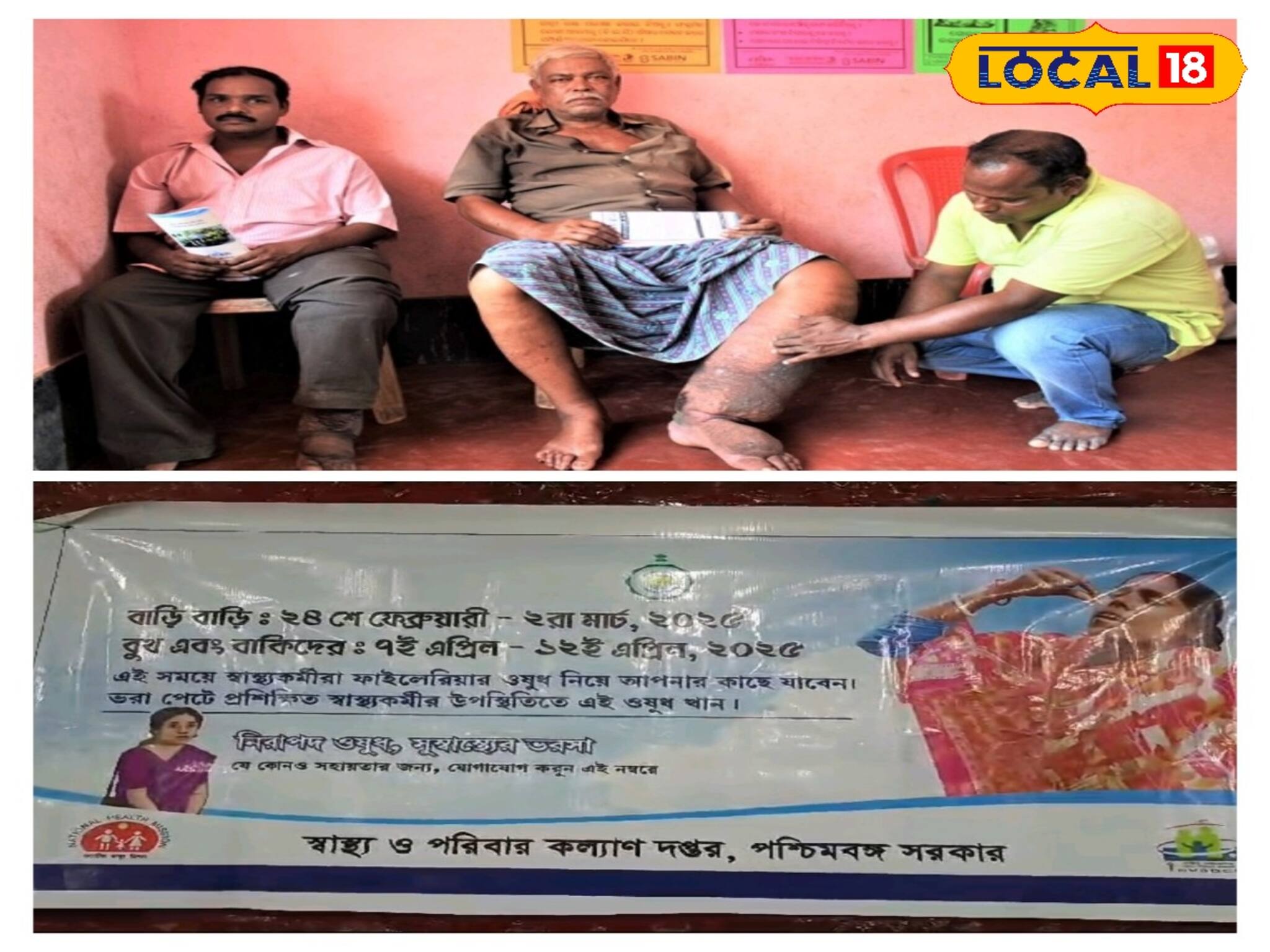 ফাইলেরিয়া মুক্ত করতে বিশেষ উদ্যোগ জেলায়! চলছে প্রচার ও ওষুধ বিতরণ