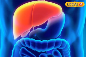 ফ্যাটি লিভারে ভুগছেন? কয়েকটি ঘরোয়া টোটকায় মুক্তি পেতে পারেন সমস্যা থেকে ফ্যাটি লিভারে ভুগছেন? কয়েকটি ঘরোয়া টোটকায় মুক্তি পেতে পারেন সমস্যা থেকে