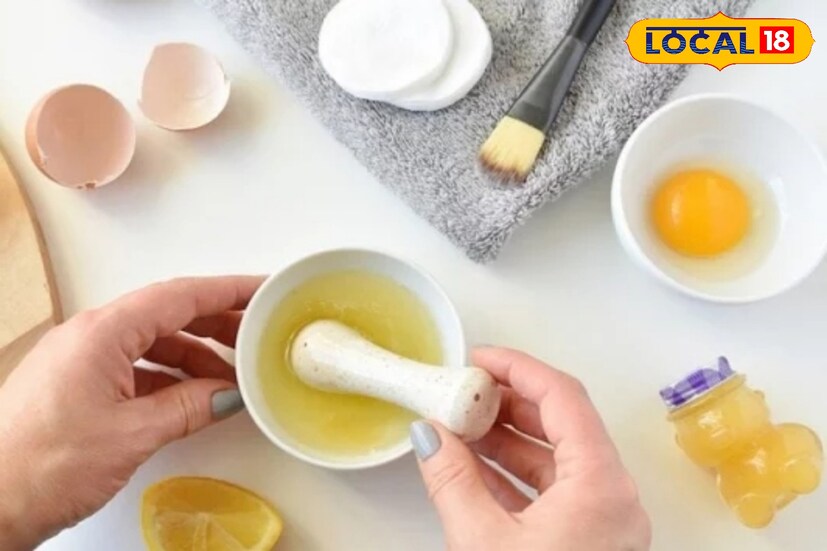 ডিমের সাদা অংশের সঙ্গে কর্নফ্লাওয়ার ও ১ চামচ চিনি মিশিয়ে নিয়ে আন্ডারআর্মসে লাগিয়ে ৩০ মিনিট পর এটা তুলতে হবে। লোমের বৃদ্ধি যে দিকে, তার বিপরীত দিকে মিশ্রণটা টেনে তুললে অবাঞ্ছিত লোম সহজেই দূর হয়ে যাবে।