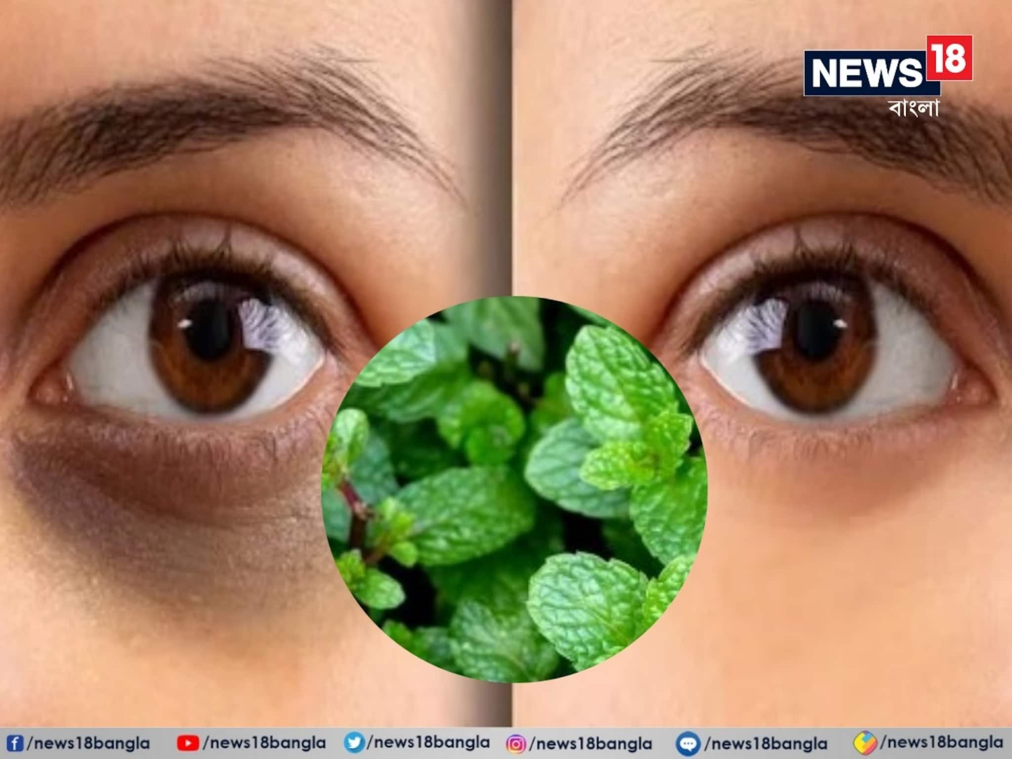 এক পাতাতেই উধাও ডার্ক সার্কেল...! ছোট্ট ঘরোয়া টোটকা জিন্দাবাদ, চাঁদের মতো ঝলঝলে মুখ!