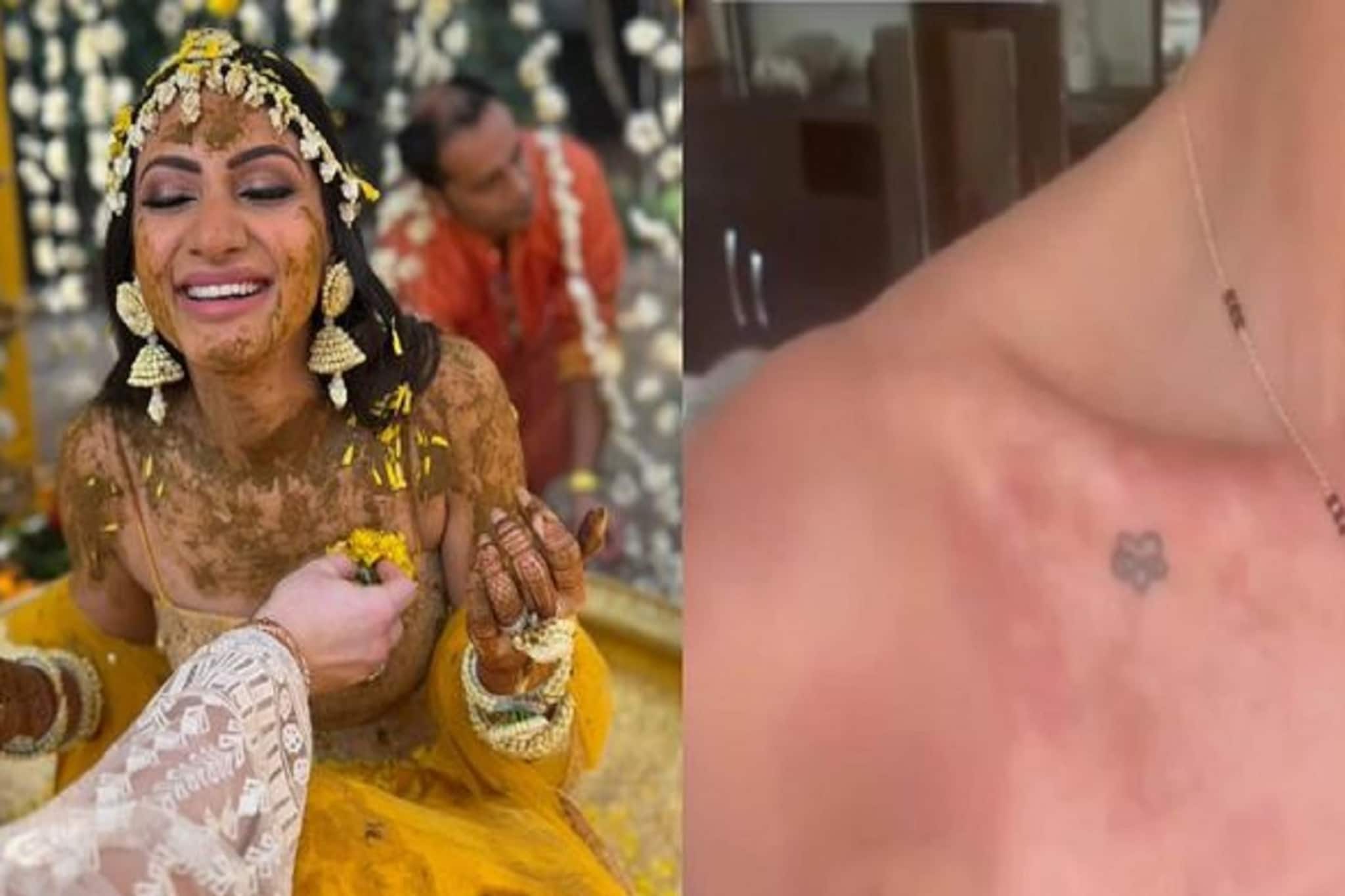 বিয়ের পরেই ত্বকে দাগড়া দাগড়া লালচে দাগ ! এ কোন বিড়ম্বনার মুখে পড়লেন নীলম