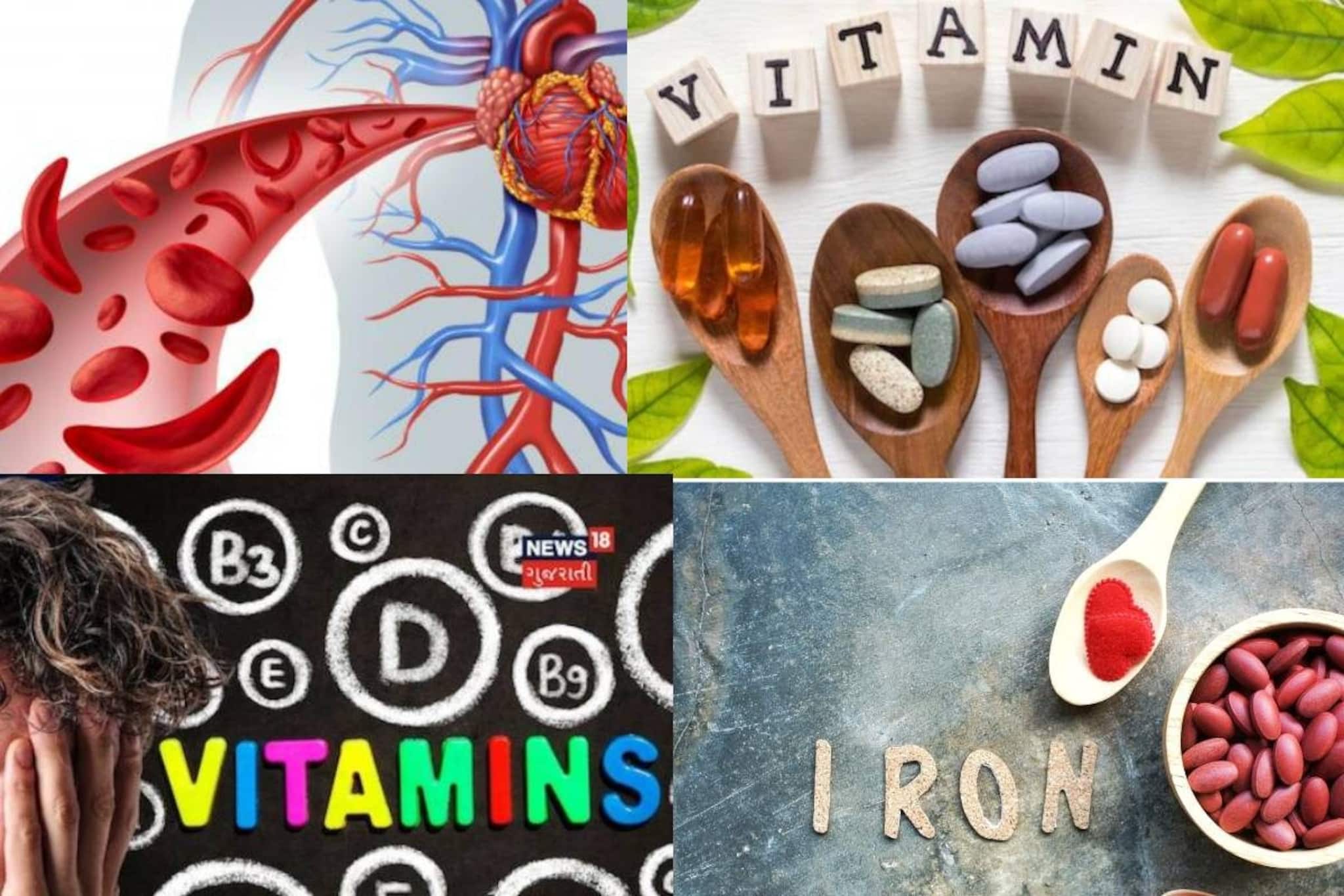 রক্তশূন্য ফ্যাকাসে শরীর! কোন ভিটামিনের অভাবে অ্যানিমিয়া হয়? কী খেলে সারবে রক্তাল্পতা?