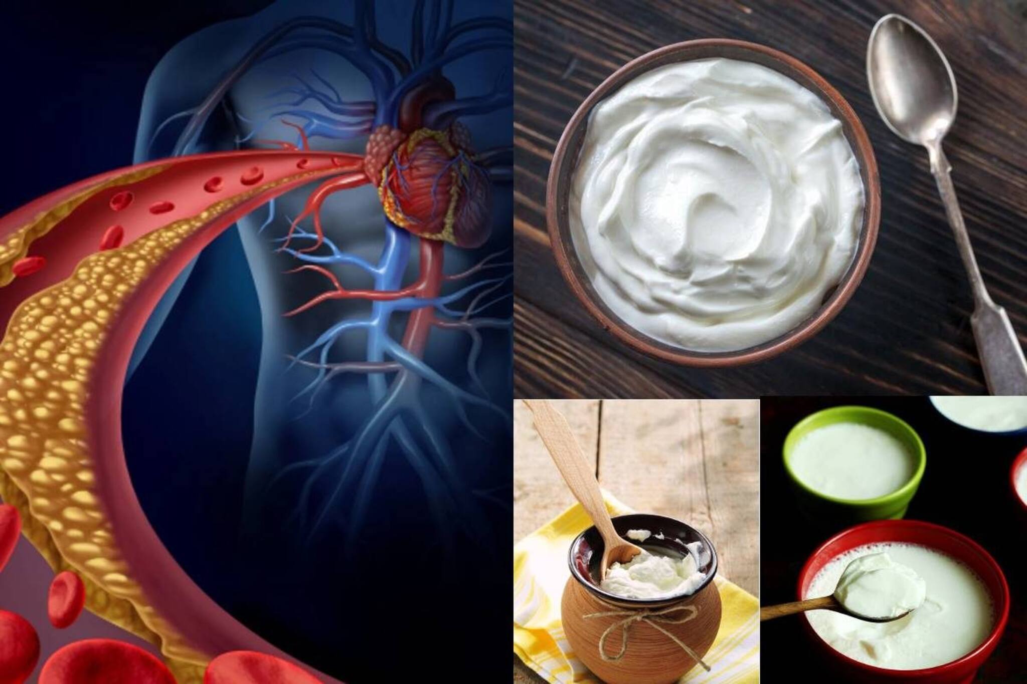 রোজ ১ বাটি টক দইয়ে ‘মেশান’ ১ ‘চিমটে’! ধমনী থেকে টেনে বার করবে খারাপ কোলেস্টেরলকে!