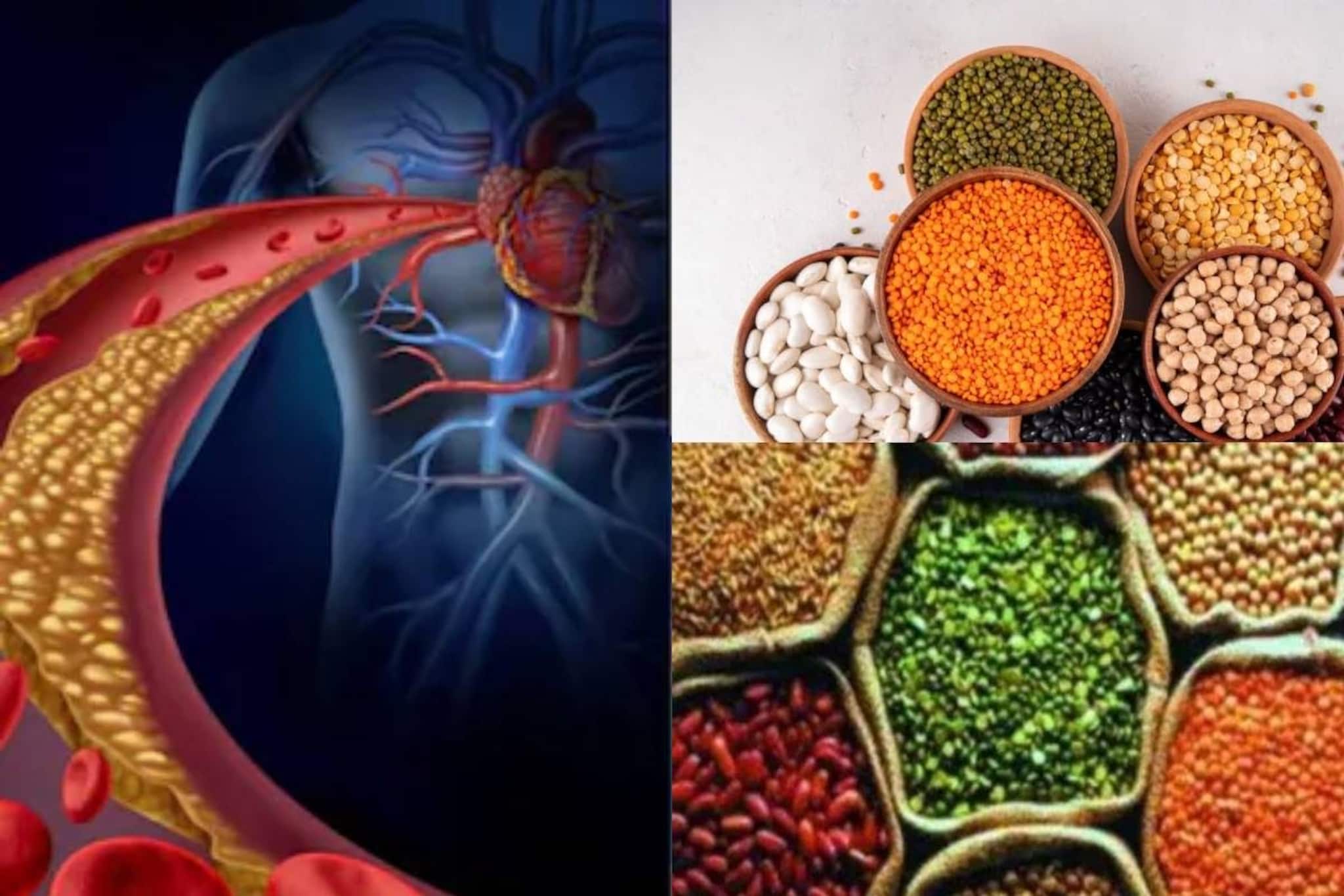 ৫ ডালের ‘পঞ্চবাণ’ শুষে নেবে ‘খারাপ কোলেস্টেরল’! কোলেস্টেরল কমাতে কোন ডাল সেরা?