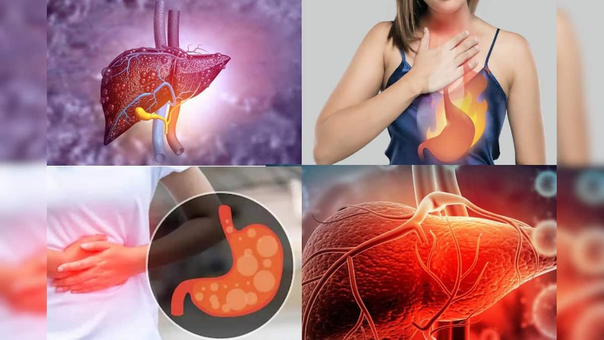 Liver Disease:সকালের চায়ে ১ চিমটে করে ২ মশলা! ধুয়েমুছে সাফ লিভারের রোগ! গ্যাস অম্বল চোঁয়া ঢেকুরের অস্বস্তি কাটিয়ে পরিষ্কার পেট