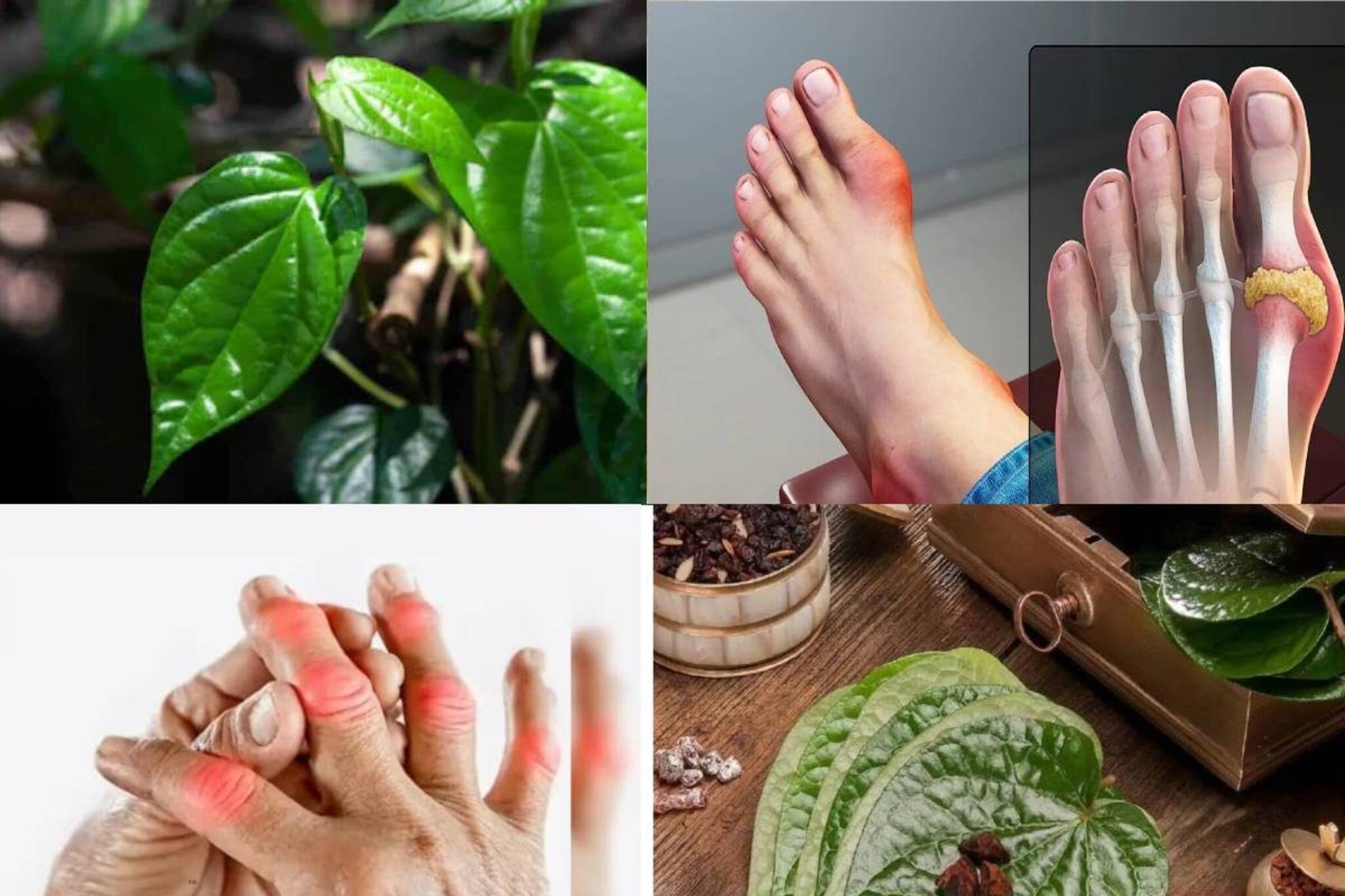 শিকড় থেকে নিংড়ে ধুয়েমুছে সাফ ইউরিক অ্যাসিড! অল্প খরচে কিডনি ভাল রাখতে এভাবে খান পানপাতা