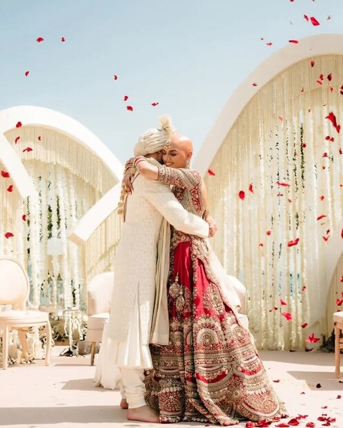 মাত্র ৬ মাস বয়সে নীহার সচদেবের অ্যালোপেসিয়া ধরা পড়ে। তবে, পরে তাঁর মুণ্ডন অনুষ্ঠানের পরে, মাথায় চুল ফিরে আসে। কিন্তু স্কুলজীবন শুরুর পরই ফের চুল ঝরে পড়ার সমস্যা ফিরে আসে। সে সময় তিনি যখন বাইরে যেতেন এবং এমনকি স্কুলে যাওয়ার সময়ও তিনি উইগ পরতেন, কারণ তাঁর পরিবার এই অবস্থা গোপন রাখার জন্য চাপ দিয়েছিল। 