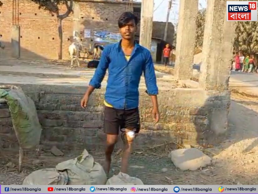 দুর্ঘটনায় হারানো স্বপ্ন---চাকুলিয়া ব্লকের কাহালাগাঁওয়ের বাসিন্দা মোকসেদ। পা হারানোর পর তার চলাফেরার একমাত্র ভরসা হয়ে ওঠে ক্রাচ বা লাঠি। স্বাভাবিক জীবন থেকে ছিটকে পড়ে সে। বন্ধুরা যখন সাইকেল চালিয়ে স্কুলে যেত বা খেলাধুলায় মেতে উঠত, তখন একপাশে বসে থাকা ছাড়া উপায় থাকত না মোকসেদের। 