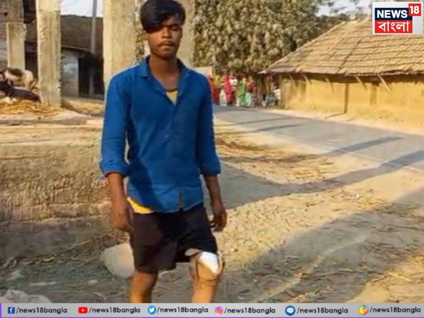 সরকারের দেওয়া প্লাস্টিকের কৃত্রিম পায়ের সাহায্যে এখন দিব্যি হাঁটাচলা করতে পারে মোকসেদ। শুধু তাই নয়, সে এখন সাইকেল চালাতে পারে, খেলাধুলায় অংশ নিতে পারে, এমনকি ছুটে দৌড়াতেও পারে। বন্ধুর সঙ্গে পাল্লা দিয়ে সাইকেল চালিয়ে স্কুল যাওয়া—এখন তার কাছে আর স্বপ্ন নয়, বাস্তব।