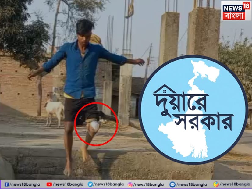 দুয়ারে সরকার ক্যাম্পে নতুন আশা---পরিবারের অসহায় অবস্থার কথা ভেবে সরকারি সাহায্যের আশায় তাঁরা সম্প্রতি দুয়ারে সরকার ক্যাম্পে যান। রাজ্য সরকারের বিশেষ উদ্যোগে ৯-১১ ফেব্রুয়ারি গোয়ালপোখর ২ নম্বর ব্লকে বিশেষভাবে সক্ষমদের জন্য ক্যাম্পের আয়োজন করা হয়েছিল। সেখানেই মোকসেদের কৃত্রিম পায়ের ব্যবস্থা করে দেন সরকারি আধিকারিকরা। 
