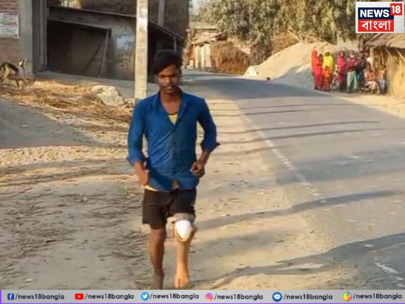 পরিবারের দুঃখ-দুর্দশা--- মোকসেদের পরিবার অত্যন্ত সাধারণ। বাবা মুজলু হক, মা জৈনগন বিবি, পাঁচ বোন ও এক ভাই নিয়ে তাঁদের সংসার। ছেলের এমন দুর্দশা দেখে চোখের জল আটকাতে পারতেন না বাবা-মা। কিন্তু নিম্নবিত্ত পরিবারের পক্ষে কৃত্রিম পায়ের ব্যবস্থা করা একেবারেই সম্ভব ছিল না। কীভাবে ছেলেকে স্বাভাবিক জীবনে ফেরানো যাবে, তা নিয়েই দুশ্চিন্তায় কাটত তাঁদের দিন। 