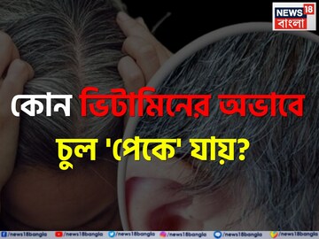 কোন 'ভিটামিনের' অভাবে অকালে চুল 'পেকে' যায় জানেন...? সতর্ক না হলেই মাথা ভরা 'সাদা' চুল! কোন 'ভিটামিনের' অভাবে অকালে চুল 'পেকে' যায় জানেন...? সতর্ক না হলেই মাথা ভরা 'সাদা' চুল!