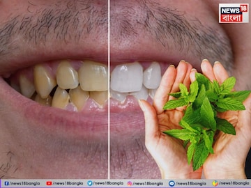 হলুদ দাঁত হবে নিমেষে সাদা! বিনামূল্যের ২-৩ পাতাই করবে কামাল! শুধু জানুন ব্যবহার হলুদ দাঁত হবে নিমেষে সাদা! বিনামূল্যের ২-৩ পাতাই করবে কামাল! শুধু জানুন ব্যবহার