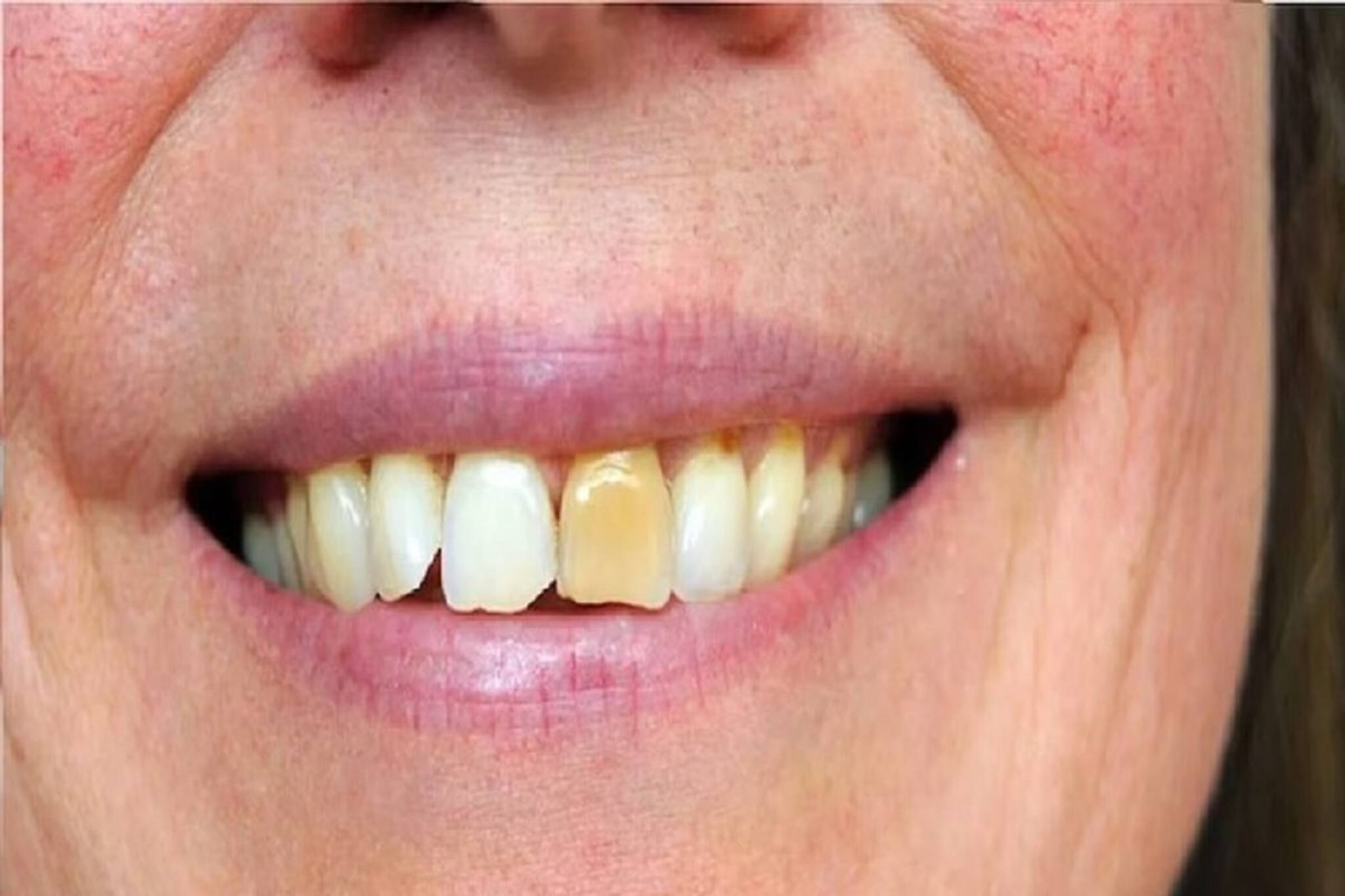 মুখের গন্ধ ও হলুদ দাঁতের কারণে চরম লজ্জা পেতে হয়! বাড়ির এই বিশেষ পাউডারেই কেল্লাফতে...