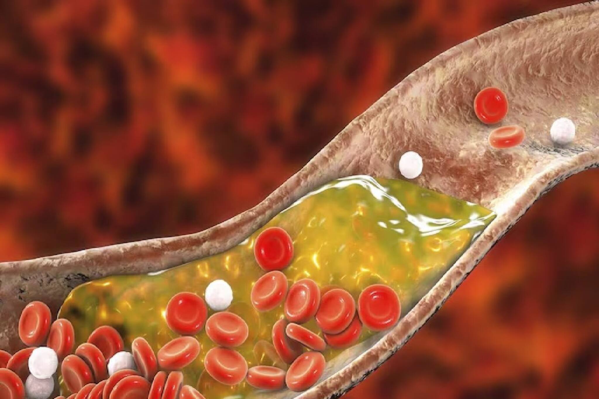 ৭ দিনেই বিষমুক্ত শরীর! ধমনী থেকে নিংড়ে বার করবে বদ কোলেস্টেরল,৫ খাবারেই বাপ বাপ বলে বেরবে