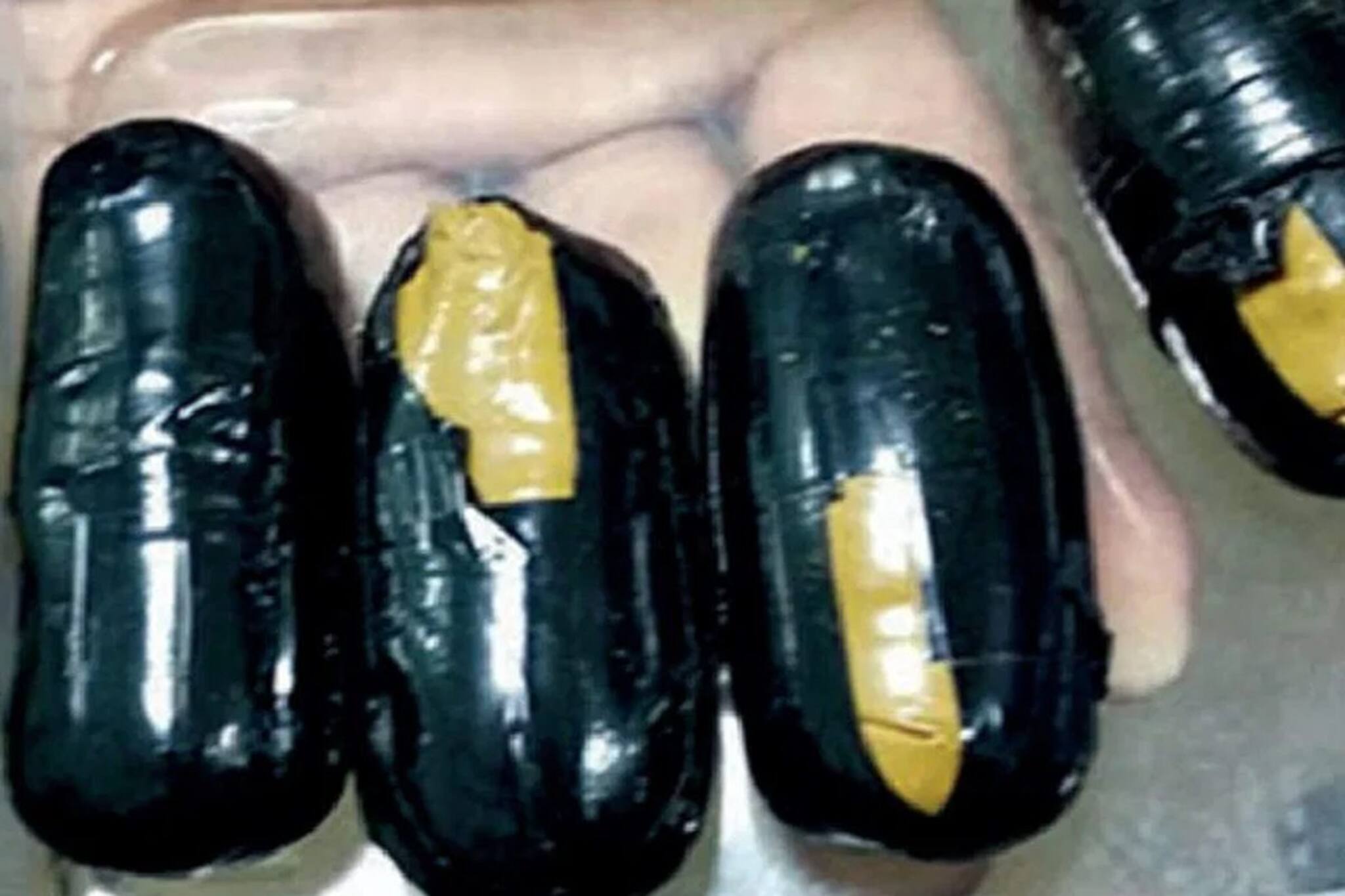 মলদ্বারে লুকনো মহামূল্যবান কোটি টাকার 'জিনিস', ধরে ফেলল বিএসএফ! শরীর থেকে যা বেরল...