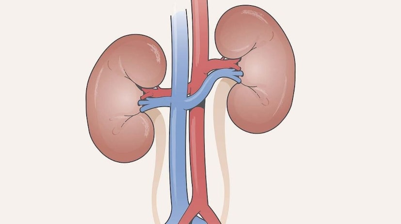 যখন খনিজ পদার্থ এবং অন্যান্য বর্জ্য পদার্থ কিডনিতে জমা হয়, তখন সেগুলি ছোট পাথরে পরিণত হয়। একে কিডনি স্টোন বলা হয়। কিডনিতে পাথর হলে ব্যথা হয়। অনেক সময় এর ফলে প্রস্রাবেও রক্ত পড়তে শুরু করে। কিডনি স্টোনের রোগীদের তাদের খাদ্যাভ্যাসের প্রতি বিশেষ যত্নবান হওয়া উচিত। যখন খনিজ পদার্থ এবং অন্যান্য বর্জ্য পদার্থ কিডনিতে জমা হয়, তখন সেগুলি ছোট পাথরে পরিণত হয়। একে কিডনি স্টোন বলা হয়। কিডনিতে পাথর হলে ব্যথা হয়। অনেক সময় এর ফলে প্রস্রাবেও রক্ত পড়তে শুরু করে। কিডনি স্টোনের রোগীদের তাদের খাদ্যাভ্যাসের প্রতি বিশেষ যত্নবান হওয়া উচিত।