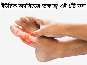 ইউরিক অ‍্যাসিডের ‘ব্রহ্মাস্ত্র’ এই ফল! রোজ ১ টা করে খেলেই ধারে কাছেও ঘেঁষবে না