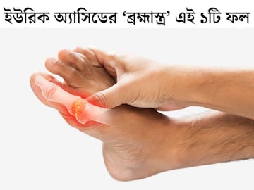 ইউরিক অ্যাসিডের ‘ব্রহ্মাস্ত্র’ এই ফল! রোজ ১ টা করে খেলেই ধারে কাছেও ঘেঁষবে না ইউরিক অ্যাসিডের ‘ব্রহ্মাস্ত্র’ এই ফল! রোজ ১ টা করে খেলেই ধারে কাছেও ঘেঁষবে না