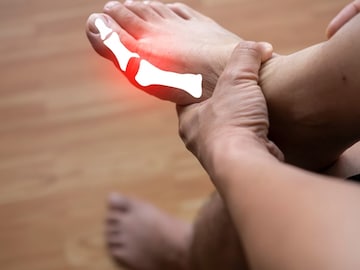 ১ সপ্তাহ খান ৫ 'প্রাকৃতিক' খাবার! ইউরিক অ্যাসিড তরতরিয়ে নামবে! উধাও হবে গেঁটেবাত-বিষব্যথা ১ সপ্তাহ খান ৫ 'প্রাকৃতিক' খাবার! ইউরিক অ্যাসিড তরতরিয়ে নামবে! উধাও হবে গেঁটেবাত-বিষব্যথা