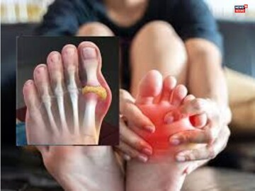 রক্ত থেকে টেনে-হিঁচড়ে নেয় ইউরিক অ্যাসিড, ৪-৫ টাকার 'এই' ফল রোজ খান, জয়েন্টের ব্যথার মুক্তি