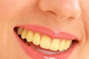 Teeth Health: 'হলুদ' দাঁত? দামি 'টুথপেস্টে' খরচ নয়, মাত্র ১০ টাকায় দাঁত করুন ধবধবে সাদা